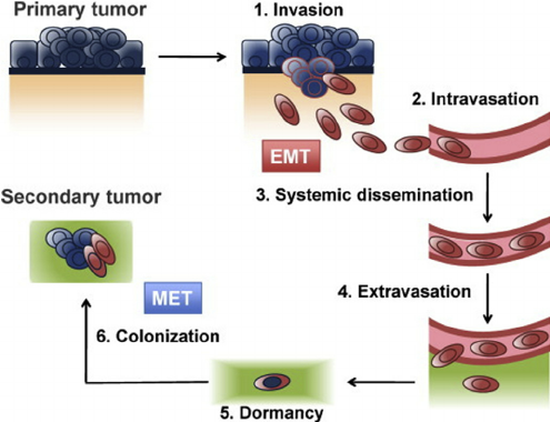 Metastatic_cascade.png
